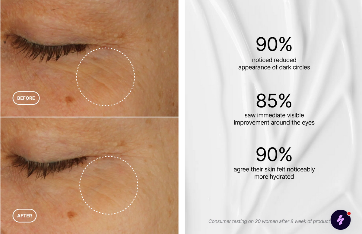 Augenserum sanfte Retinol Alternative vegan