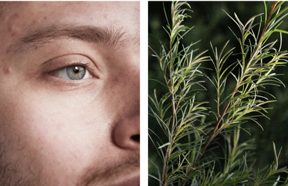 Feuchtigkeitscreme zur Aknepflege - vegan